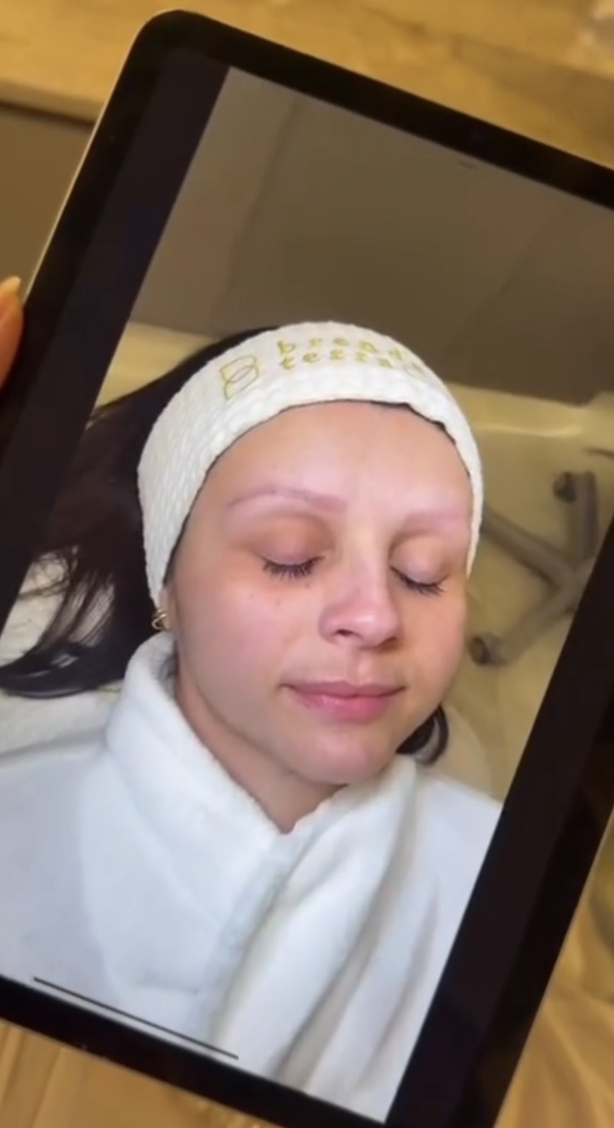 Diagnostic des sourcils